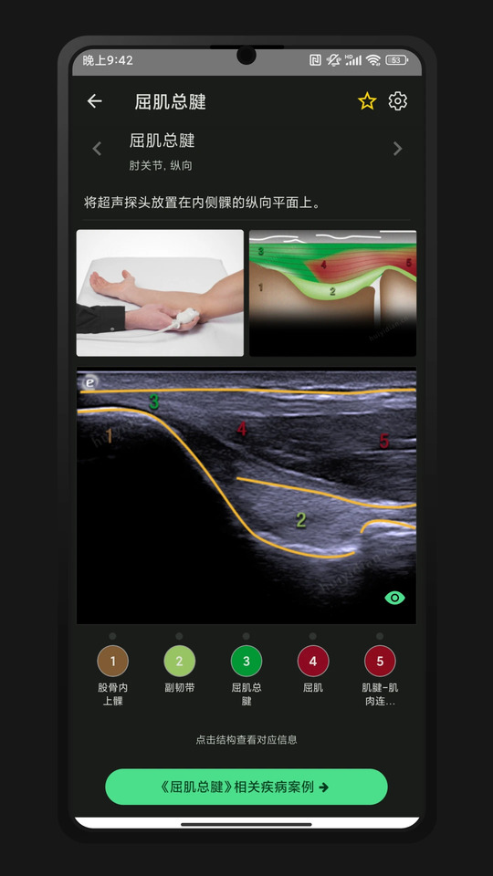 超声智学
